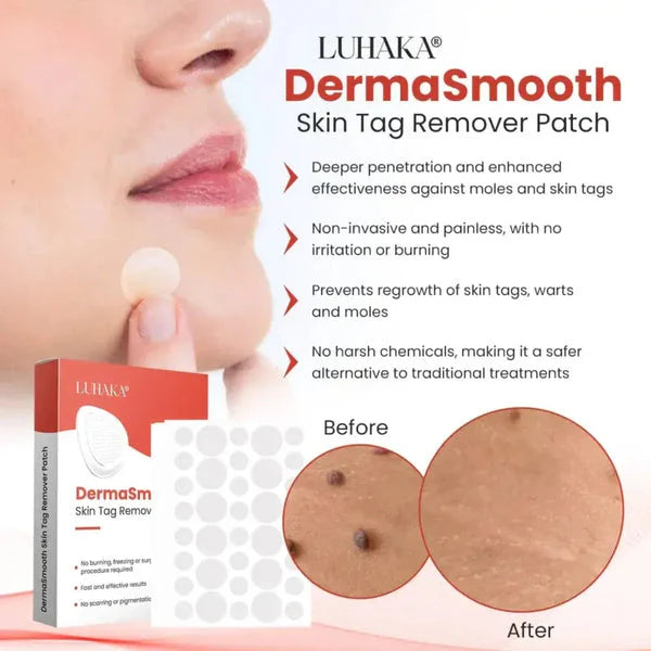 Derma Smooth Skin Tag Removal Patch -