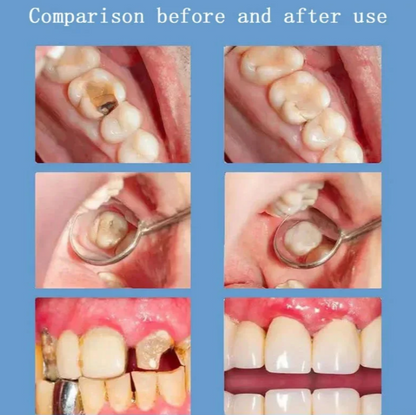 YAYASHI SP-4 Probiotic Whitening Tooth